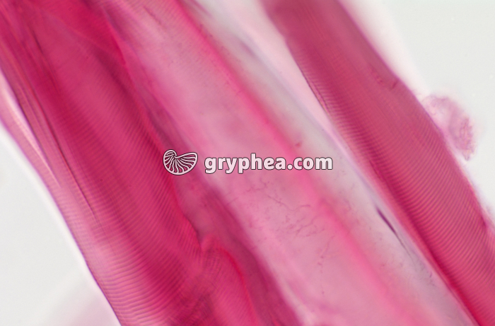 Fibres musculaires dissociées x150 - gryphea.com